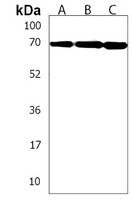 ERVK-7 Rabbit Polyclonal Antibody