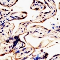 ERVK-7 Rabbit Polyclonal Antibody