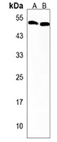 PIGU Rabbit Polyclonal Antibody