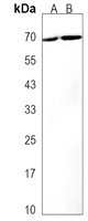 ZBTB7C Rabbit Polyclonal Antibody