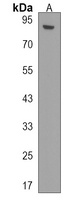 L3MBTL1 Rabbit Polyclonal Antibody