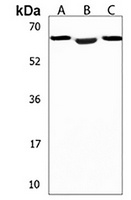 DMRT2 Rabbit Polyclonal Antibody