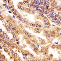 Anti-GMCL1 Antibody