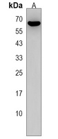 FBXO33 Antibody