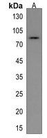 ADAM21 Rabbit Polyclonal Antibody