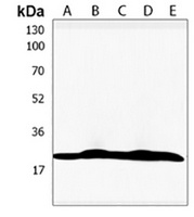 TMEM97 Rabbit Polyclonal Antibody