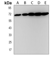 ZFP64 Rabbit Polyclonal Antibody