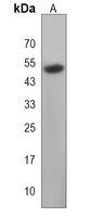S-arrestin Rabbit Polyclonal Antibody