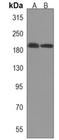 Cav2.1 Rabbit Polyclonal Antibody