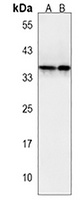OR2T7 Rabbit Polyclonal Antibody
