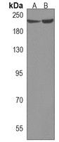 Cav1.4 Rabbit Polyclonal Antibody
