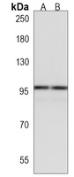 Adenylate Cyclase 5 Rabbit Polyclonal Antibody