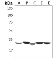SPPL2B Rabbit Polyclonal Antibody