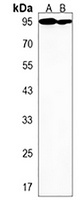 Pendrin Rabbit Polyclonal Antibody