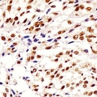 Anti-HNRNPA1L2 Antibody