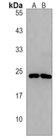 SEC11C Antibody