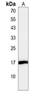HIST3H2A Rabbit Polyclonal Antibody