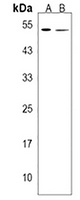 Carboxypeptidase A5 Rabbit Polyclonal Antibody