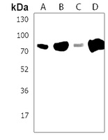 NEK10 Rabbit Polyclonal Antibody