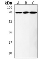 ACSF2 Rabbit Polyclonal Antibody