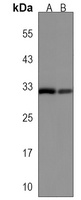 BPIFA3 Rabbit Polyclonal Antibody