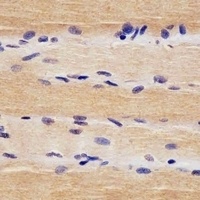 Anti-USP47 Antibody