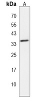 AKR7L Antibody