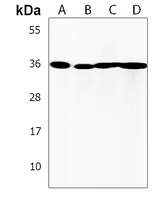 AKR7L Rabbit Polyclonal Antibody