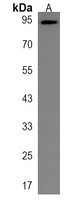 CTAGE6 Antibody
