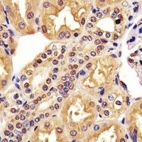 Anti-MAML2 Antibody