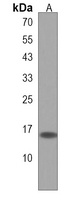 BOD1 Antibody
