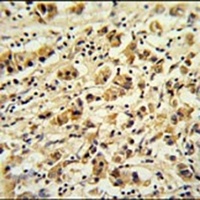 Anti-DDX49 Antibody