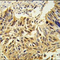 Anti-SDPR Antibody