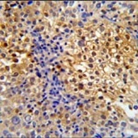 Anti-PRPF38A Antibody