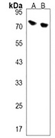 DCP1B Rabbit Polyclonal Antibody