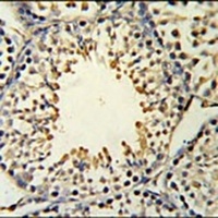 Anti-ACSBG2 Antibody