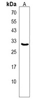 PGP Rabbit Polyclonal Antibody