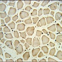 PGP Rabbit Polyclonal Antibody