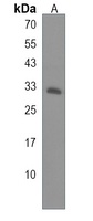 HSD17B11 Antibody