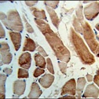 Anti-MMAA Antibody