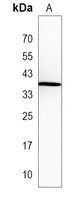 MARC1 Rabbit Polyclonal Antibody