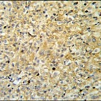 MAPK1IP1L Antibody