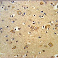 Anti-LRRTM1 Antibody