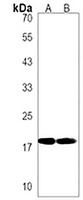 RPS11 Rabbit Polyclonal Antibody
