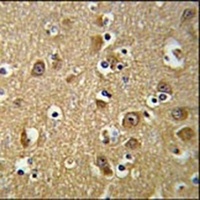 Anti-YIPF5 Antibody