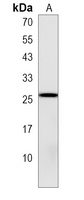 PSF1 Rabbit Polyclonal Antibody