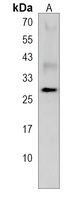 PNPO Rabbit Polyclonal Antibody