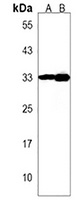 IMP4 Rabbit Polyclonal Antibody