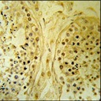 IMP4 Rabbit Polyclonal Antibody