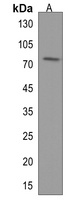 DDX17 Antibody